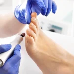 Edinburgh’s Best Podiatry Clinic for Foot Pain Solutions