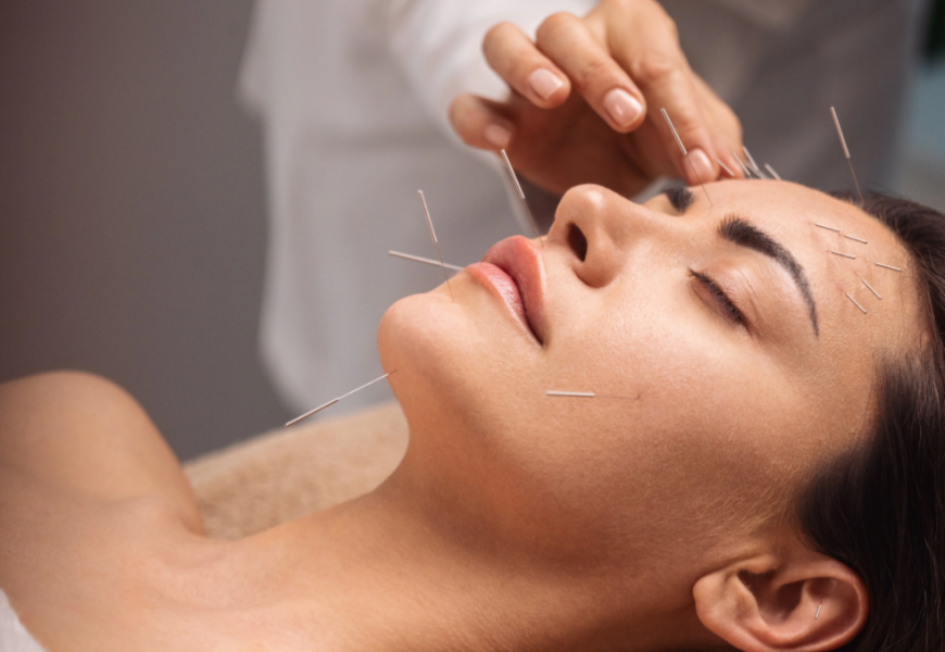 Best Cosmetic Acupuncturist